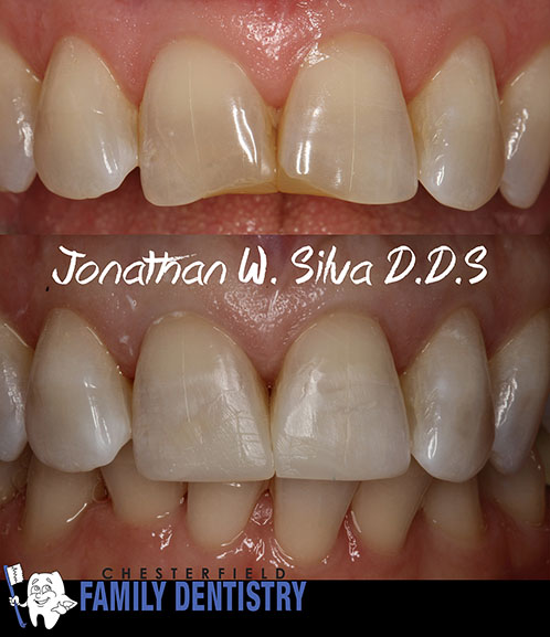 Picture of our past dental work of customers